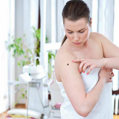 Common Types of Skin Cancer