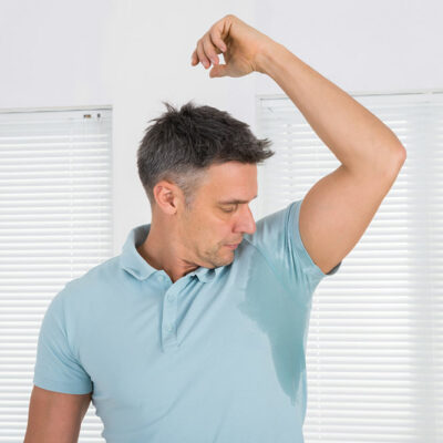 Important Things to Know about Botox for Excess Sweating