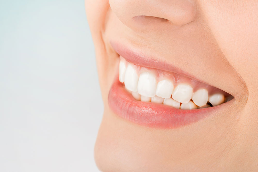 Natural Ways to Whiten Your Teeth