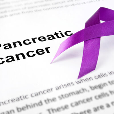 Pancreatic Cancer Symptoms to Know About