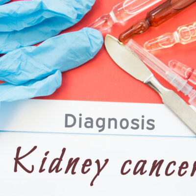 Common Causes of Kidney Cancer