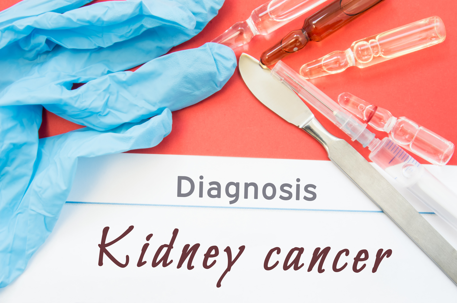 Common Causes of Kidney Cancer